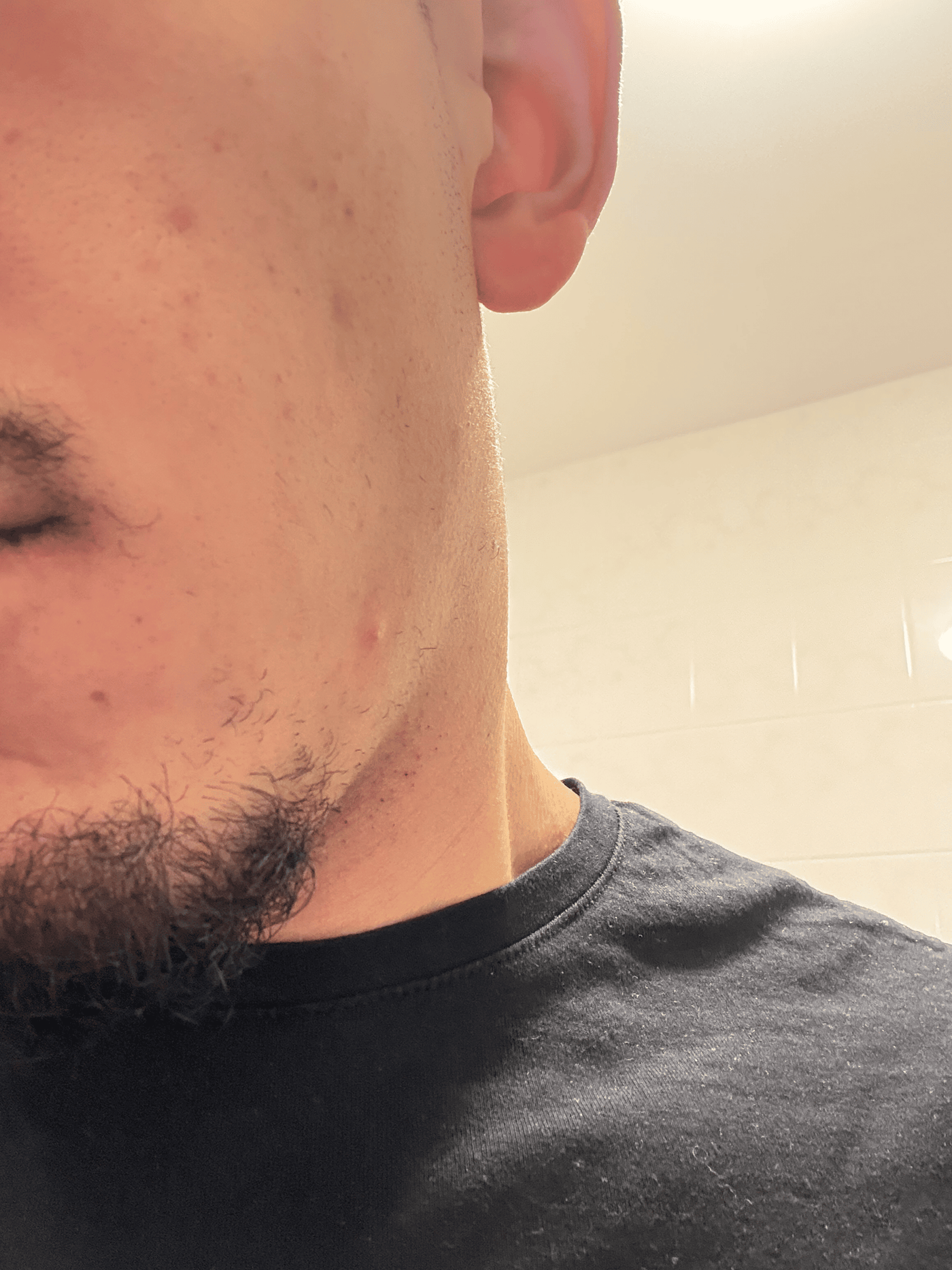 Before foto